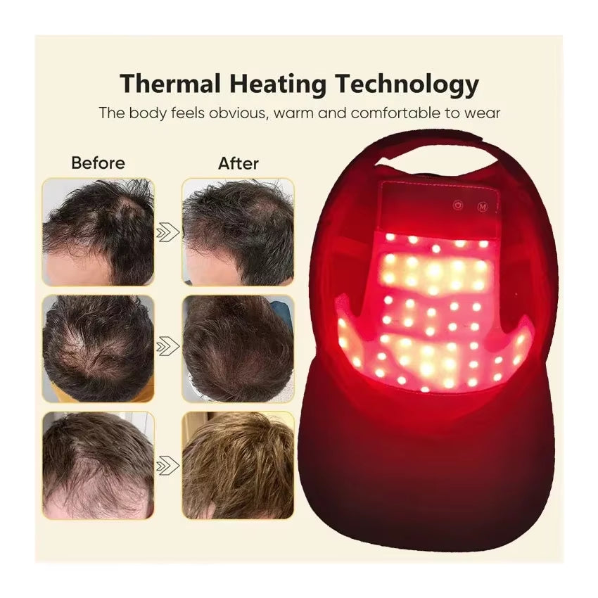 Red Light Scalp Therapy Cap – At-Home LED Hair Care Device