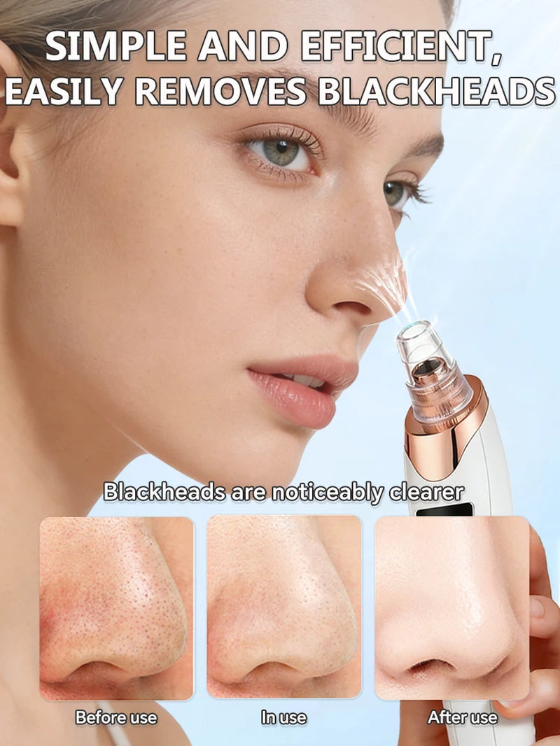 Rechargeable Blackhead Vacuum Pore Extractor Tool