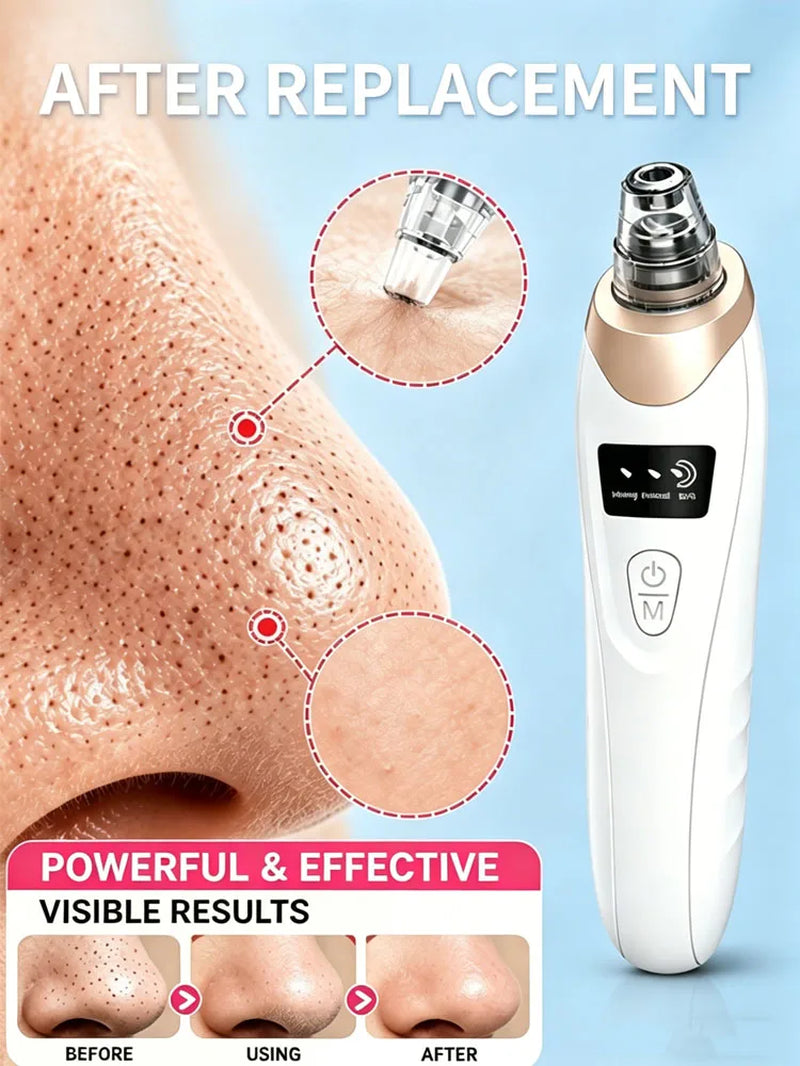 Rechargeable Blackhead Vacuum Pore Extractor Tool