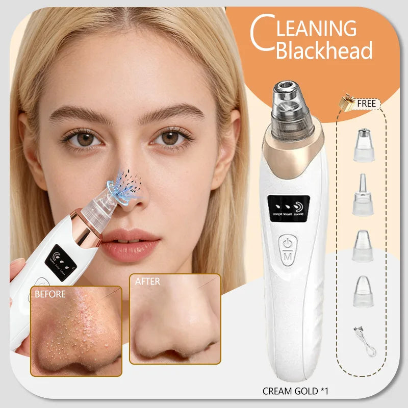 Rechargeable Blackhead Vacuum Pore Extractor Tool
