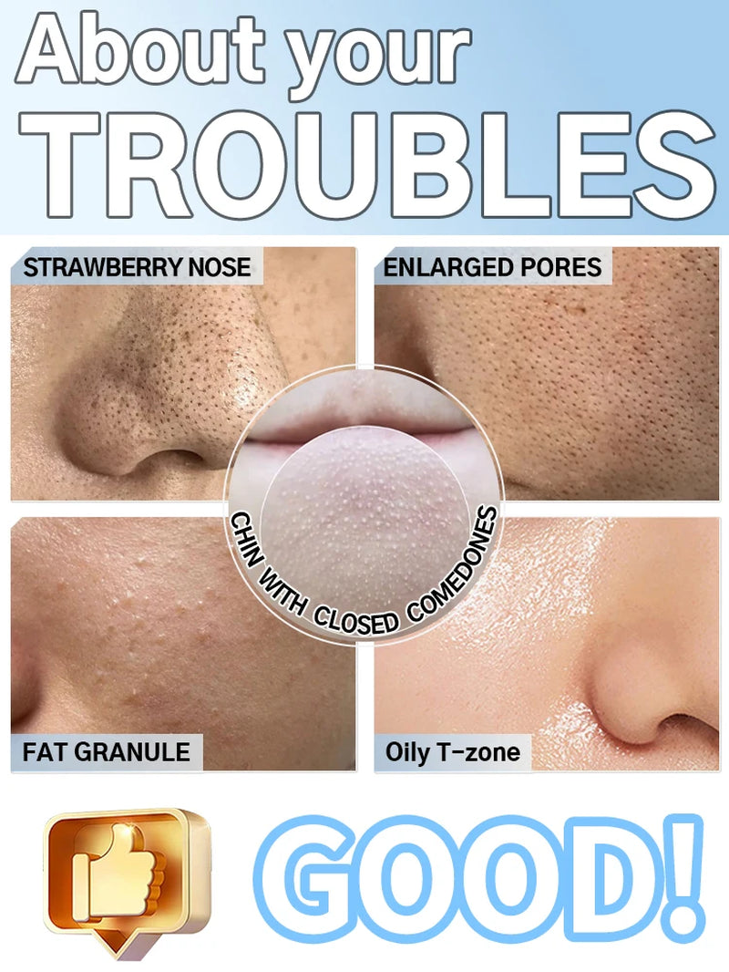 Rechargeable Blackhead Vacuum Pore Extractor Tool