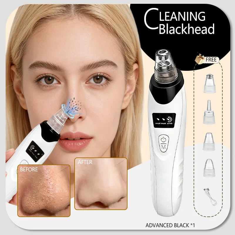Rechargeable Blackhead Vacuum Pore Extractor Tool