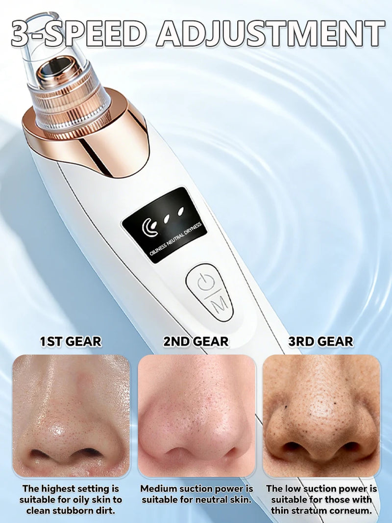 Rechargeable Blackhead Vacuum Pore Extractor Tool
