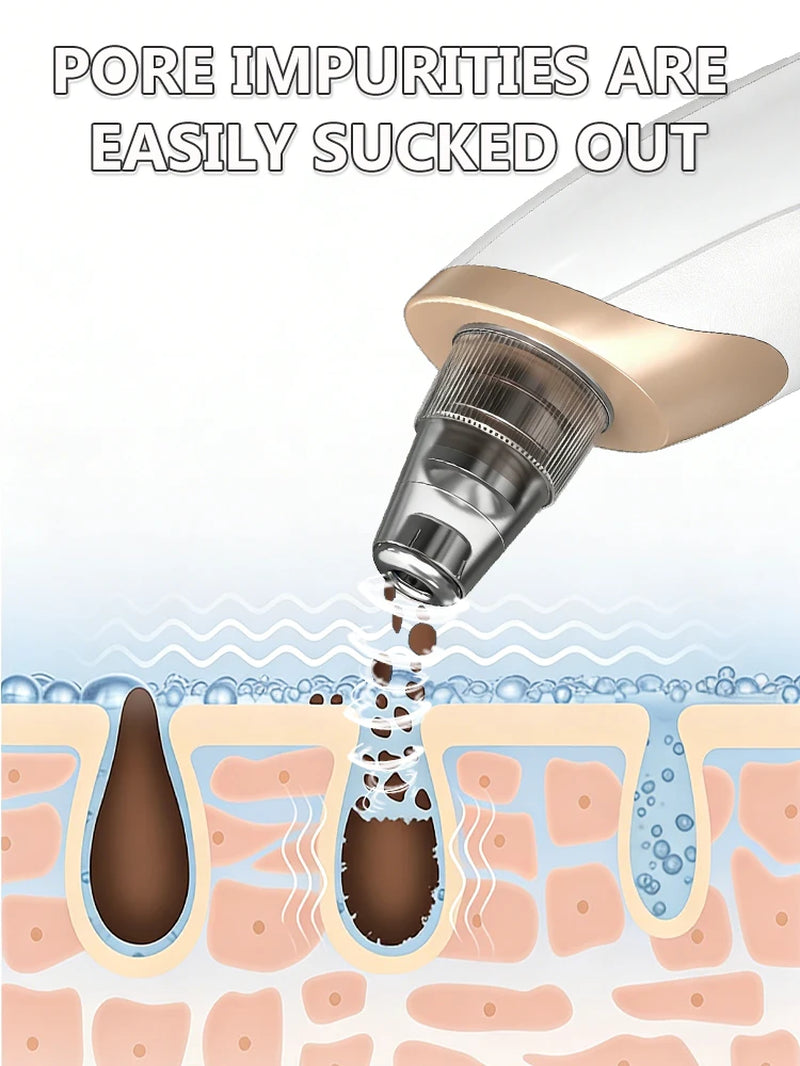 Rechargeable Blackhead Vacuum Pore Extractor Tool